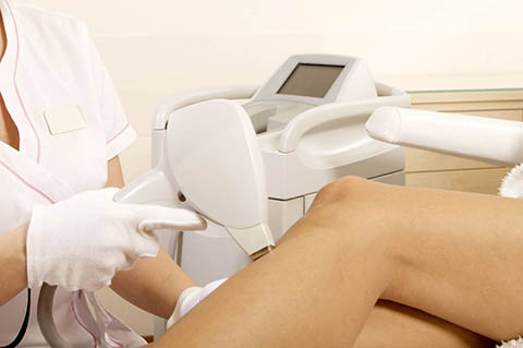 Épilation au laser LightSheer (jambes)